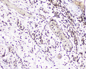 UBE2I UBC9 Rabbit Polyclonal Antibody