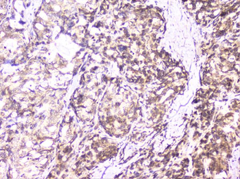 UBE2I UBC9 Rabbit Polyclonal Antibody