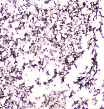 UBE2I UBC9 Rabbit Polyclonal Antibody
