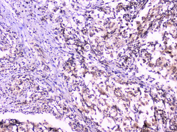 UBE2I UBC9 Rabbit Polyclonal Antibody
