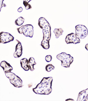 UBE2I UBC9 Rabbit Polyclonal Antibody