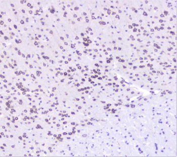 UBE2I UBC9 Rabbit Polyclonal Antibody