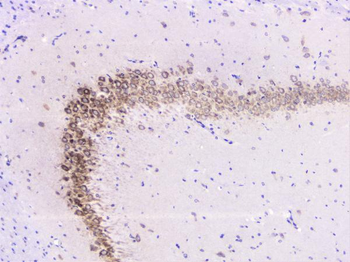 UBE2I UBC9 Rabbit Polyclonal Antibody