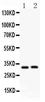 IL1 beta/IL1B Rabbit Polyclonal Antibody