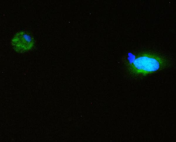 SQSTM1/p62 Rabbit Polyclonal Antibody