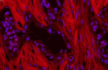 SQSTM1/p62 Rabbit Polyclonal Antibody