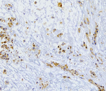 SQSTM1/p62 Rabbit Polyclonal Antibody