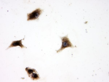 SQSTM1/p62 Rabbit Polyclonal Antibody