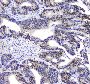 SQSTM1/p62 Rabbit Polyclonal Antibody