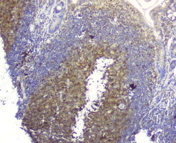 SQSTM1/p62 Rabbit Polyclonal Antibody