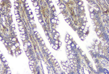 SQSTM1/p62 Rabbit Polyclonal Antibody