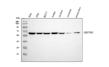 SQSTM1/p62 Rabbit Polyclonal Antibody