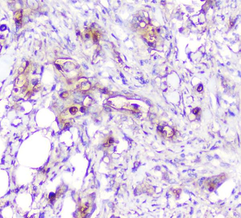 ADA Mouse Monoclonal Antibody