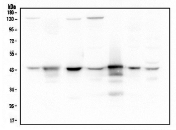 ADA Mouse Monoclonal Antibody