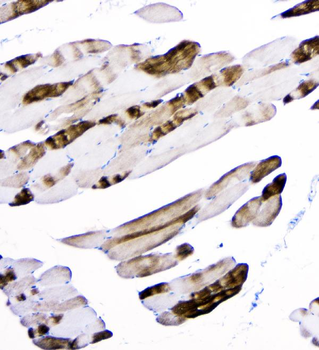 ACTN3 Mouse Monoclonal Antibody