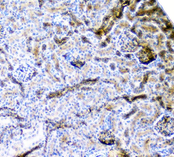 CD2AP Mouse Monoclonal Antibody