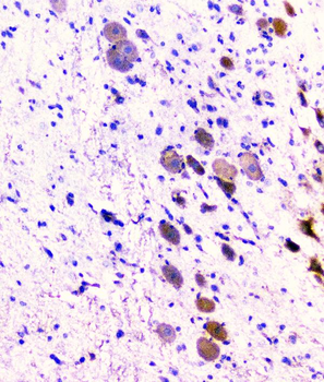 CD2AP Mouse Monoclonal Antibody