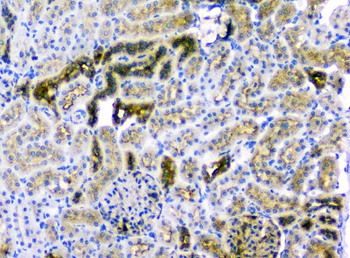 CD2AP Mouse Monoclonal Antibody