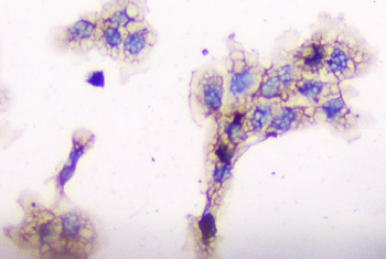 CD2AP Mouse Monoclonal Antibody