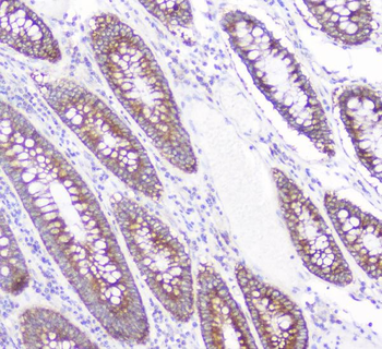 CD2AP Mouse Monoclonal Antibody