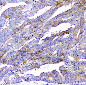 CD2AP Mouse Monoclonal Antibody