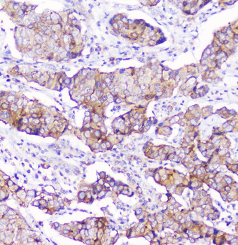 CD2AP Mouse Monoclonal Antibody