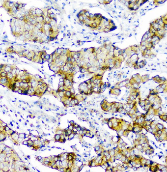CD2AP Mouse Monoclonal Antibody