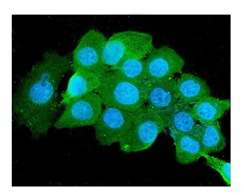 Beta 2 Microglobulin B2M Mouse Monoclonal Antibody