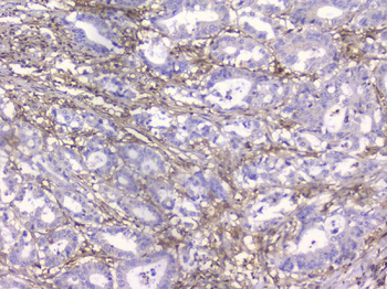 Beta 2 Microglobulin B2M Mouse Monoclonal Antibody