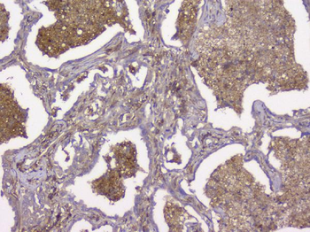 Beta 2 Microglobulin B2M Mouse Monoclonal Antibody