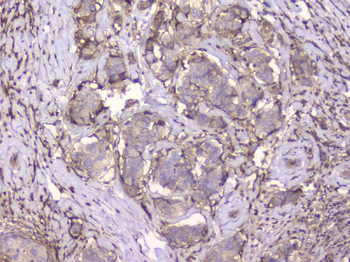 Beta 2 Microglobulin B2M Mouse Monoclonal Antibody