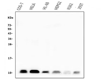 Beta 2 Microglobulin B2M Mouse Monoclonal Antibody