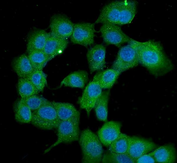 PPID Mouse Monoclonal Antibody