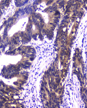PPID Mouse Monoclonal Antibody