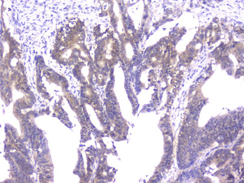 PPID Mouse Monoclonal Antibody