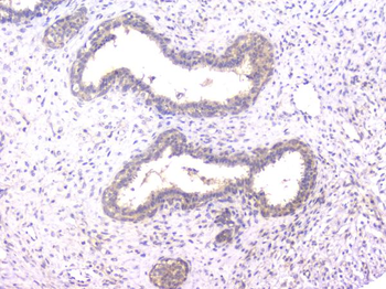 PPID Mouse Monoclonal Antibody