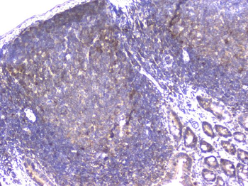 PPID Mouse Monoclonal Antibody