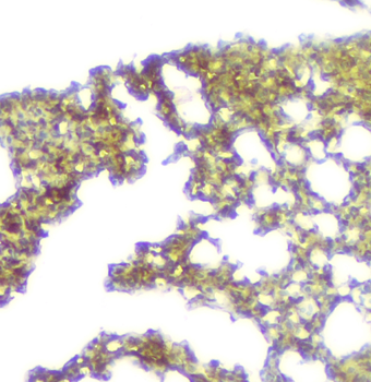 Calpain 2 CAPN2 Mouse Monoclonal Antibody