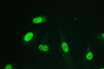 RPA70 RPA1 Mouse Monoclonal Antibody