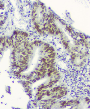 RPA70 RPA1 Mouse Monoclonal Antibody