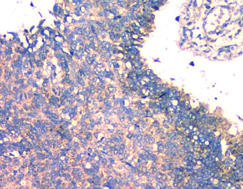 FH Mouse Monoclonal Antibody