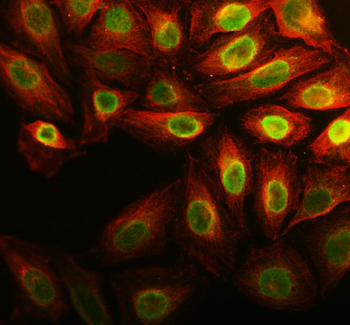 Anillin/ANLN Rabbit Polyclonal Antibody