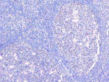 BCL6 Rabbit Polyclonal Antibody