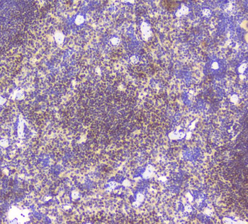 BCL6 Rabbit Polyclonal Antibody