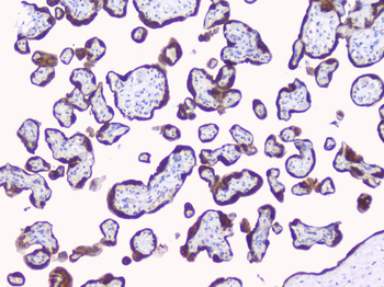 Aromatase/CYP19A1 Rabbit Polyclonal Antibody
