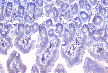 Aromatase/CYP19A1 Rabbit Polyclonal Antibody