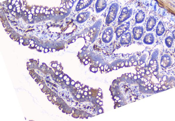 Aromatase/CYP19A1 Rabbit Polyclonal Antibody