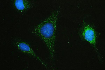 Hyaluronan synthase 1/HAS1 Rabbit Polyclonal Antibody