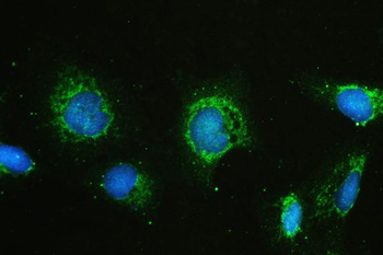 Hyaluronan synthase 1/HAS1 Rabbit Polyclonal Antibody