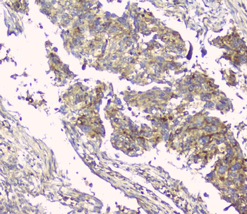 Hyaluronan synthase 1/HAS1 Rabbit Polyclonal Antibody